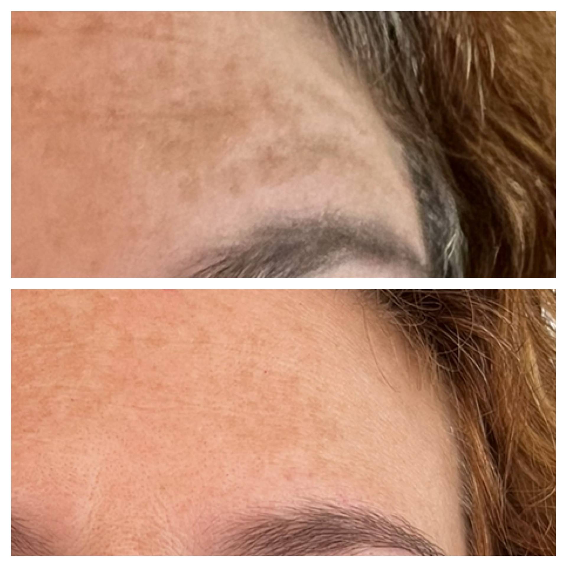 Resultado facial 3